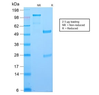 Recombinant Bcl6 Antibody