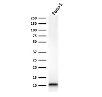 S100A4 Antibody / FSP1