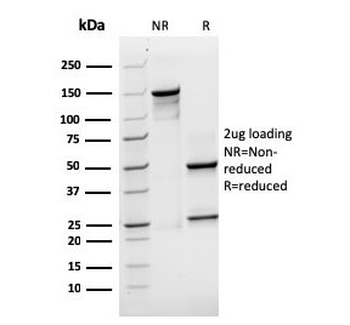 Recombinant SOX2 Antibody