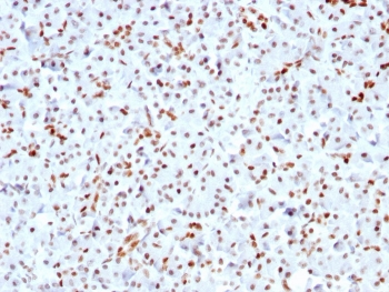 Recombinant SOX9 Antibody