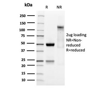 Recombinant SOX9 Antibody