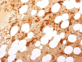 Recombinant CD71 Antibody / Transferrin Receptor / TFRC (Extracellular domain)