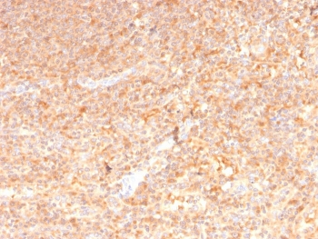 GM-CSF Antibody