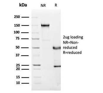 C1QA Antibody / Complement C1q A-Chain