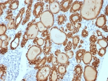 Recombinant Thyroid Peroxidase Antibody