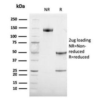 TRP1 / Tyrosinase-Related Protein-1 Antibody / TYRP1