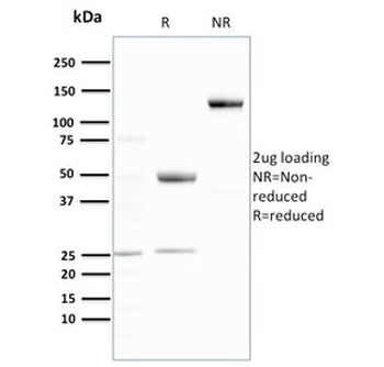 Recombinant Ubiquitin Antibody