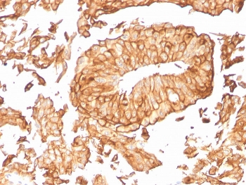 UPK1B Antibody / Uroplakin 1B