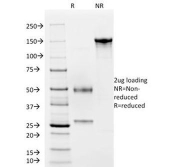 Recombinant vWF Antibody / von Willebrand Factor