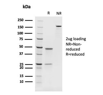 Recombinant PAX8 Antibody