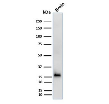 CALB2 Antibody / Calbindin 2 / Calretinin