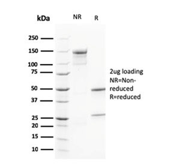 CALB2 Antibody / Calbindin 2 / Calretinin