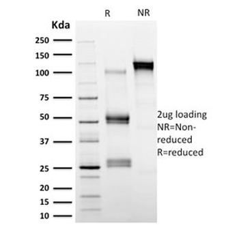 Calpastatin Antibody
