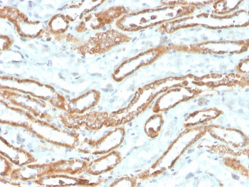 Recombinant Aurora B Antibody / AURKB