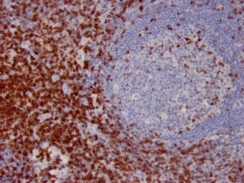 CD7 Antibody