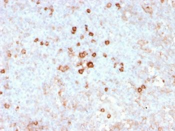 Recombinant CD14 Antibody