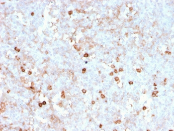 Recombinant CD14 Antibody