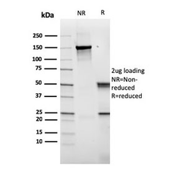 Recombinant CD14 Antibody