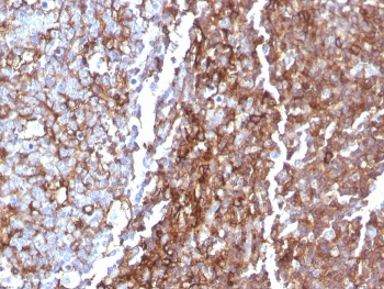 CD44 Antibody / HCAM