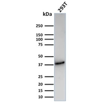 Recombinant CD74 / CL Antibody