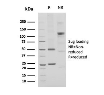Recombinant CD74 / CL Antibody