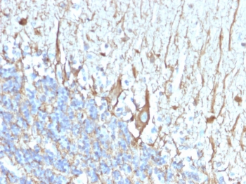 Neurofilament Antibody (Heavy + Light)
