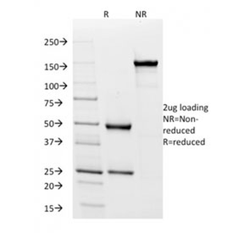 Recombinant Pan-HLA Antibody (DP/DQ/DR)