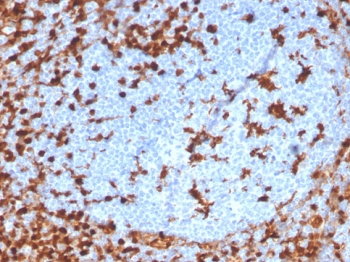 Recombinant Annexin A1 Antibody