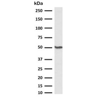 Beta Tubulin Antibody / TUBB3