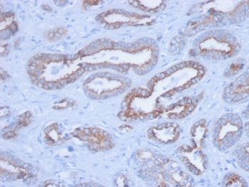 Pan Cytokeratin Antibody Cocktail (Acidic + Basic)