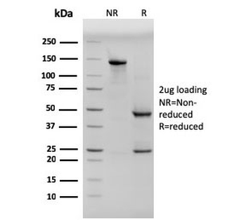 Pan Cytokeratin Antibody Cocktail (Acidic + Basic)