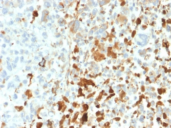 Recombinant Vimentin Antibody