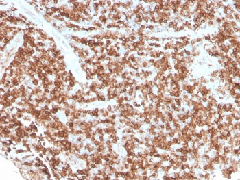 Recombinant CD74 Antibody