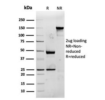 Recombinant CD74 Antibody