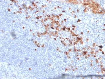 CD5L Antibody / CD5 Ligand