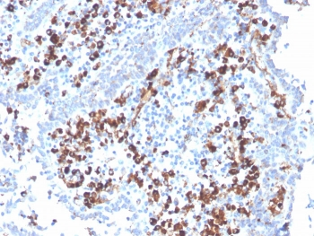 CD5L Antibody / CD5 Ligand