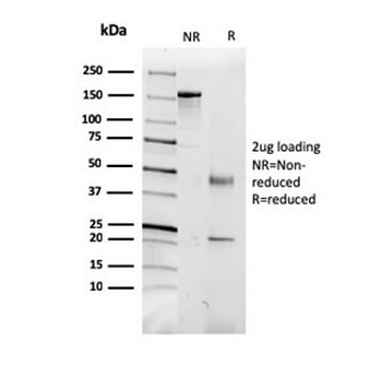 CD5L Antibody / CD5 Ligand