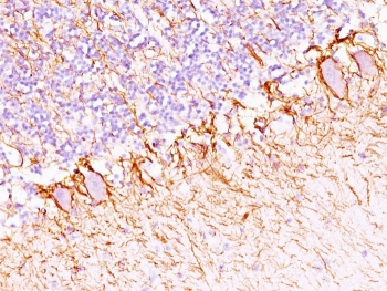 Neurofilament Antibody Cocktail (Heavy + Light)