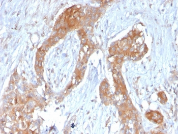 A20 Antibody / TNFAIP3