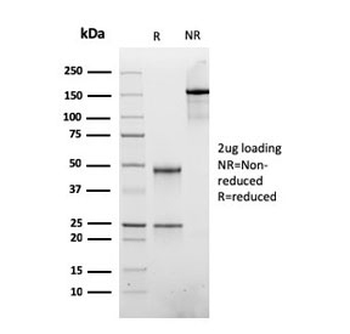 Recombinant ATRX Antibody