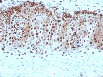 Recombinant c-Myc Antibody