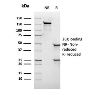 Recombinant c-Myc Antibody