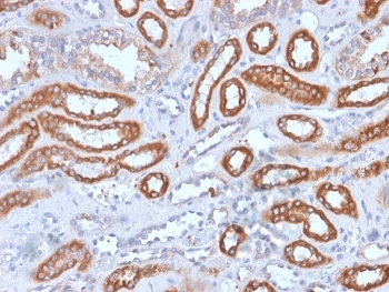Recombinant CD61 Antibody