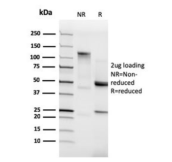 Recombinant CDH2 Antibody / N-Cadherin / CD325