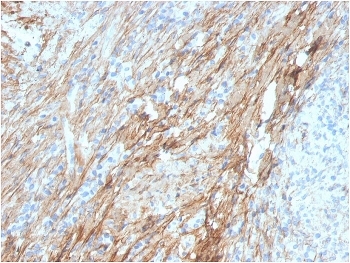 Fibronectin Antibody