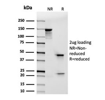 Recombinant ITGAE Antibody / Integrin alpha E / CD103