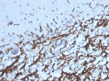 Recombinant Myelin Basic Protein Antibody