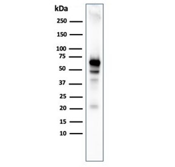 Recombinant AKT1 Antibody