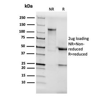 Recombinant AKT1 Antibody