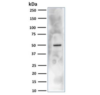 CA9 Antibody / Carbonic Anhydrase IX
